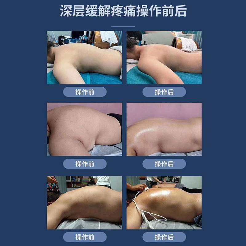 三通大师经络仪生物微电疏通经络按摩拔罐调理疗养生仪器灸导仪新