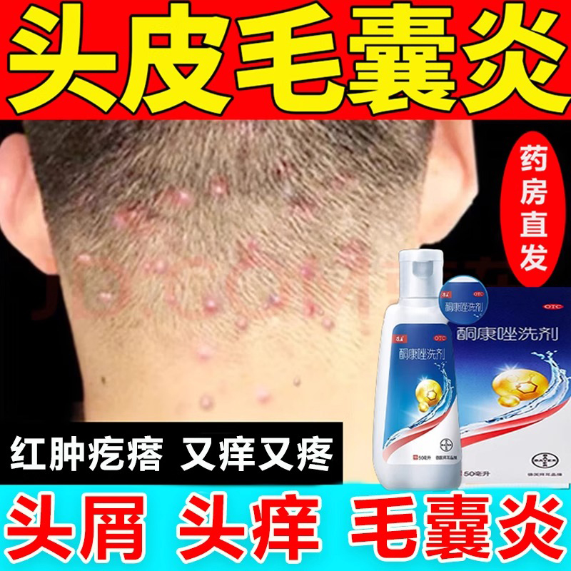 【七里香】酮康唑洗剂2%*50ml/瓶