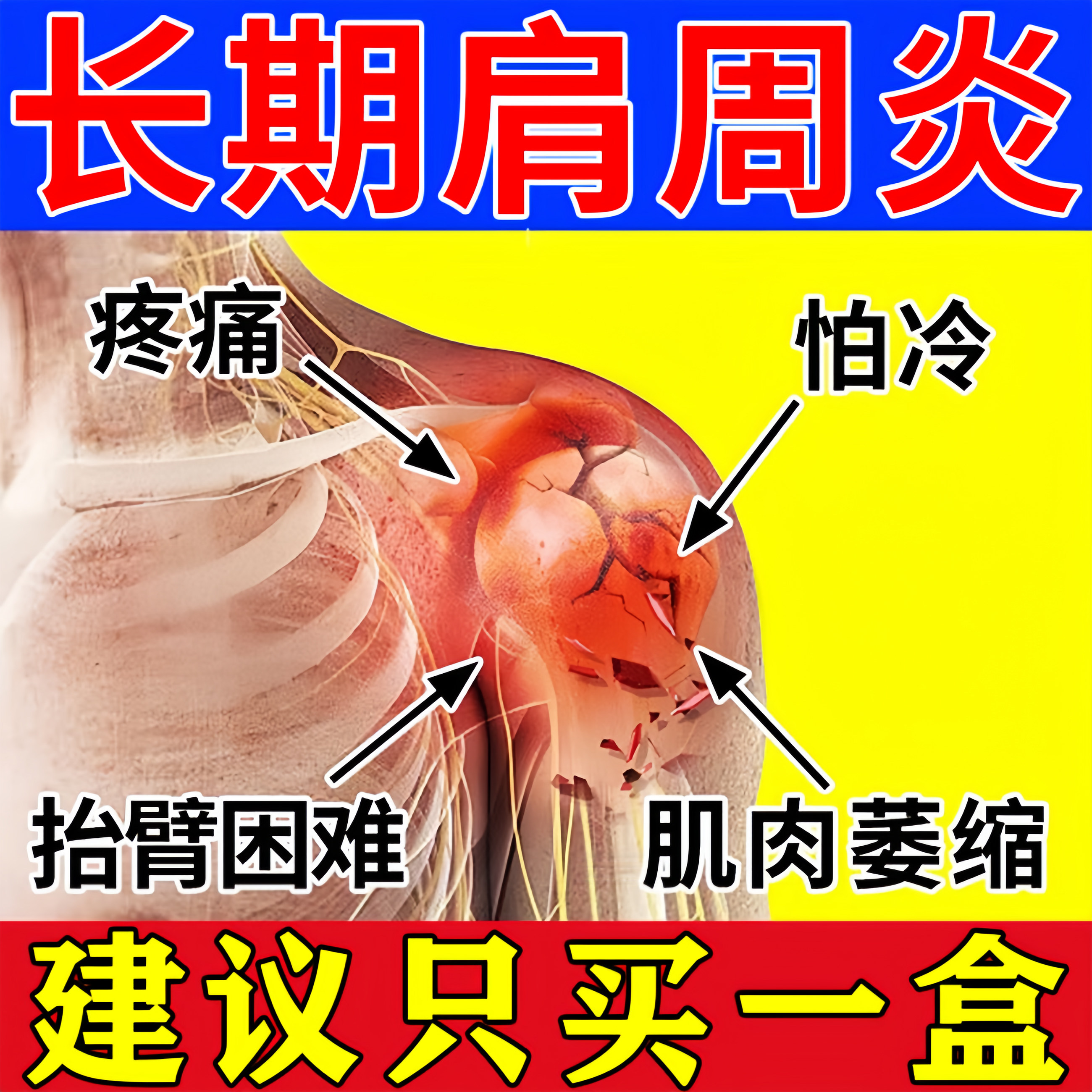 肩周炎贴膏壮骨麝香止痛膏10贴舒筋活血化瘀疏通经络肩膀疼痛专用