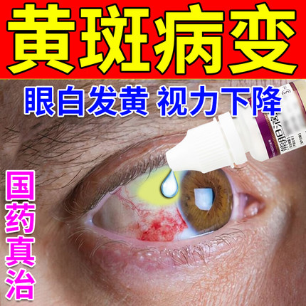 眼白清澈去黄修复发黄眼睛红血丝眼底黄斑病变眼药水熊胆滴眼液dd
