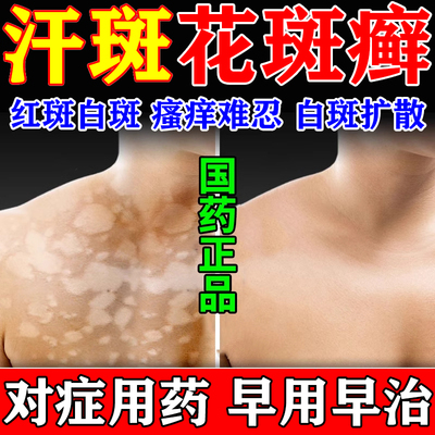 治汗斑花斑癣专用药手癣体癣皮肤真菌感染斑点汗斑花斑癣专用药膏