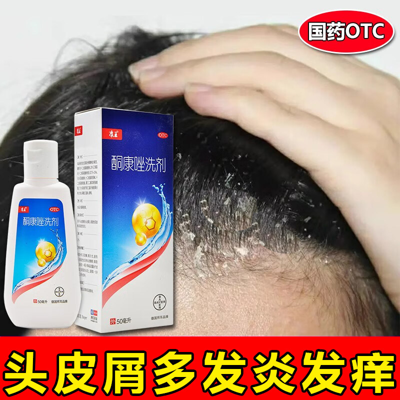 头皮屑严重去头屑药治疗头皮瘙痒脂溢性皮炎毛囊炎康王酮康唑洗剂