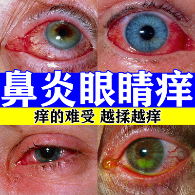 【宝彤】珍珠明目滴眼液8ml*1支/盒