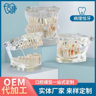儿童病理恒牙模型透明模型可看牙根牙冠教学专用模型