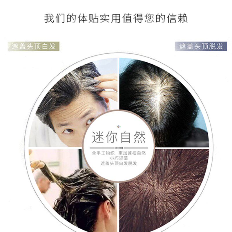 遮盖白发假发片头顶补发片女真人发丝增加发量补发块女一片式无痕