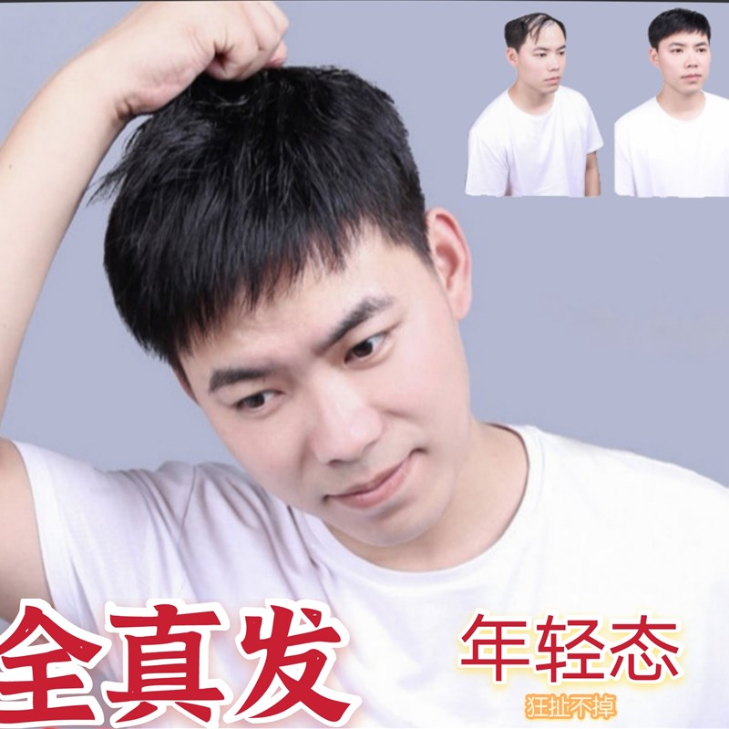 假发男头顶前额补发片寸头短发中老年翻盖真发发际线隐形光头发套