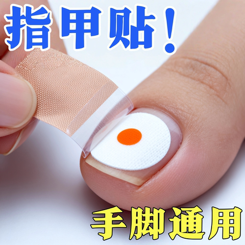 植物萃取指甲脚趾手指贴正品专用