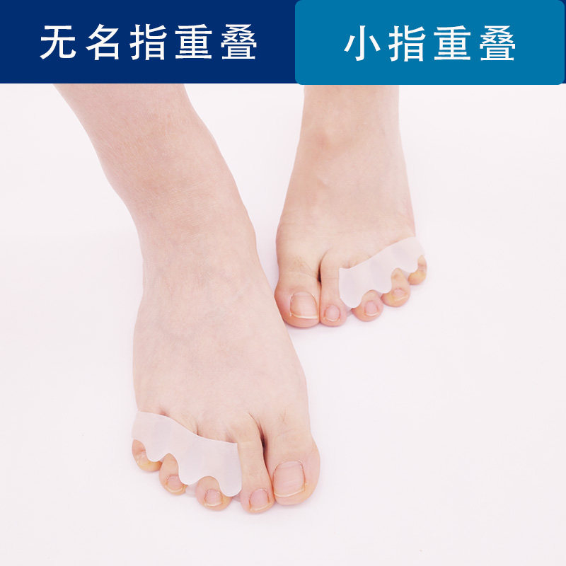 无名指内翻分趾器小脚趾小拇指外翻矫正器保护套拇外翻重叠趾分离