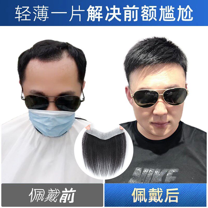 发际线贴男假发片男士全真人发丝前额假刘海m型背头真发补发片男