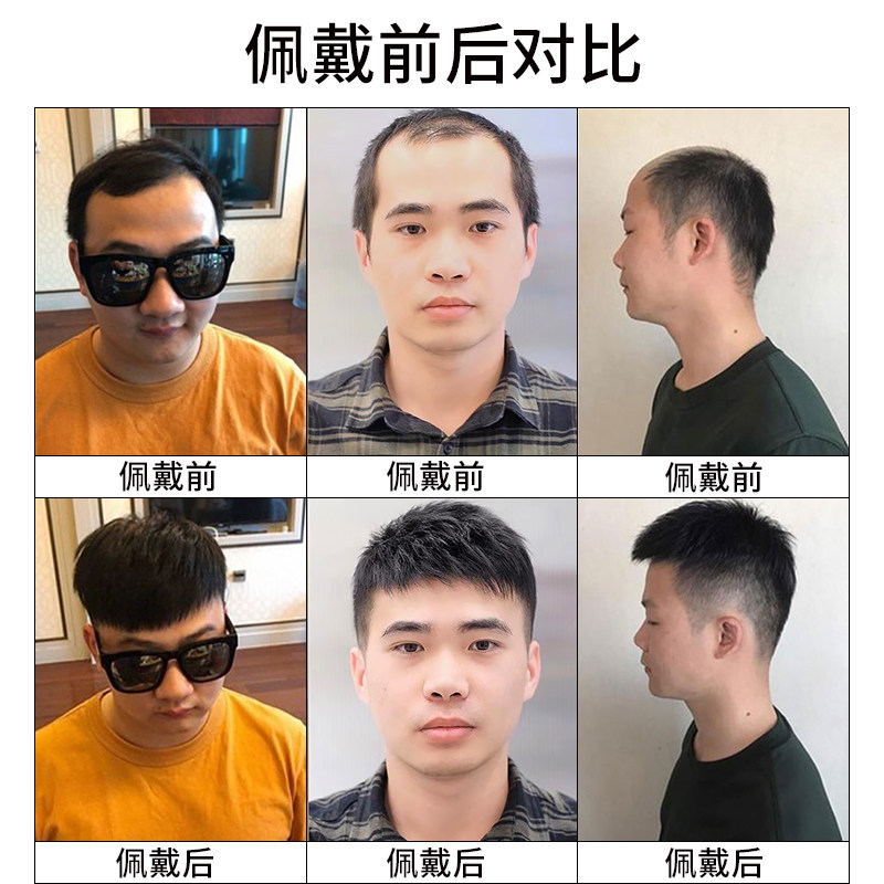 假发男短发寸头真发帅气隐形假发片头顶补发秃顶真人发丝男士假发