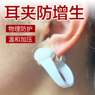 耳夹防增生耳洞耳垂术后防增生疤痕疙瘩压力贴/夹凸起去除疙瘩
