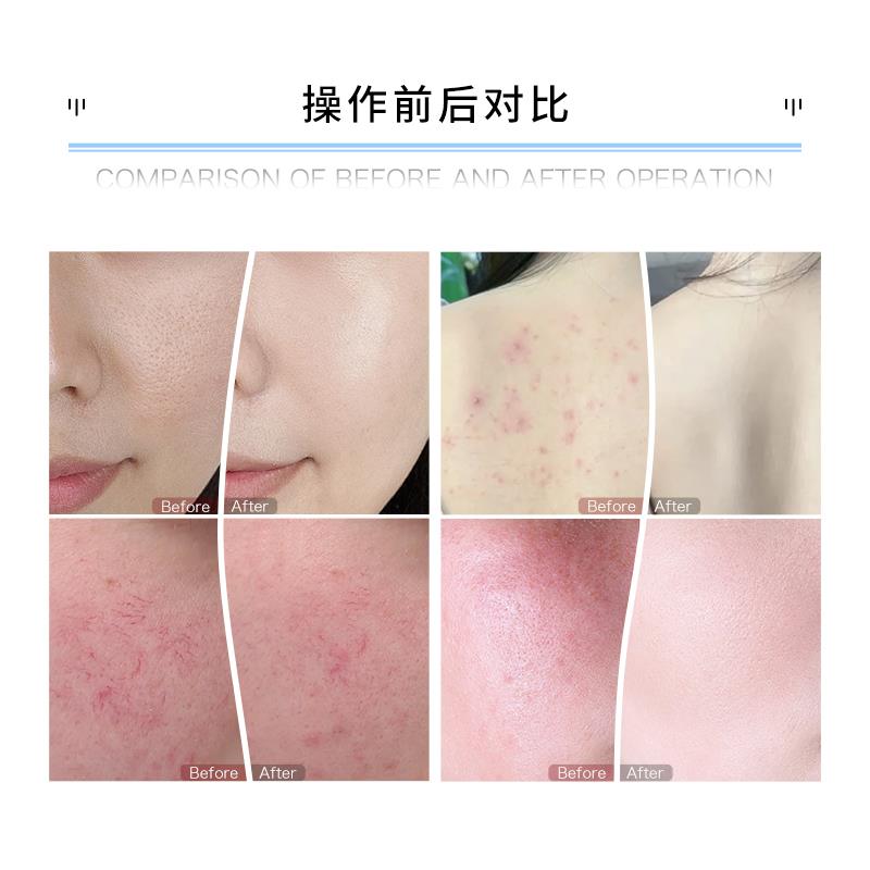 26红蓝光大排灯PDT光疗仪折叠光谱仪美容院专用光子嫩肤美容仪器