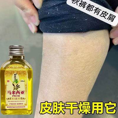 皮肤干燥保湿补水身上掉皮屑小腿鱼鳞皮肤粗糙滋润防干燥护肤甘油