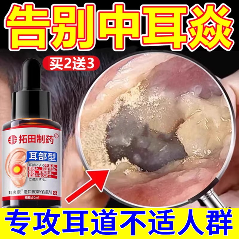 日本特效【100%艮治中耳炎】