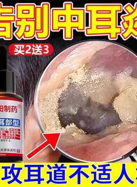中耳炎滴耳液可用专除耳朵根痒特消炎感染止痒效抑真菌人用膏