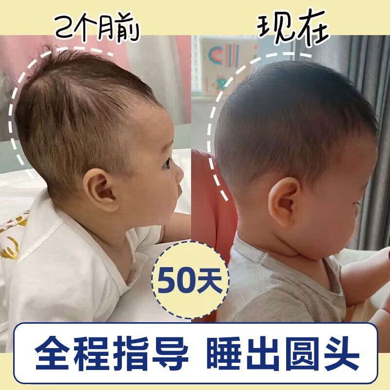 婴儿睡圆头神器定型枕新生儿防偏头矫正扁头纠正头型宝宝硅胶枕头