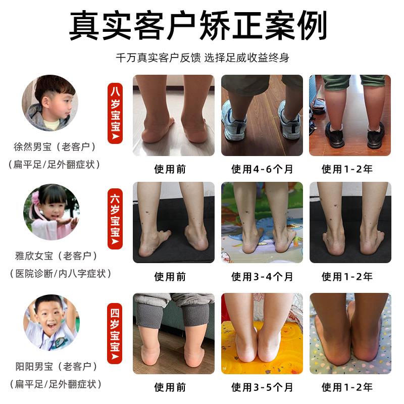 儿童足外翻鞋垫内八字矫正垫儿童XO型腿矫正器扁平足弓支撑纠正垫
