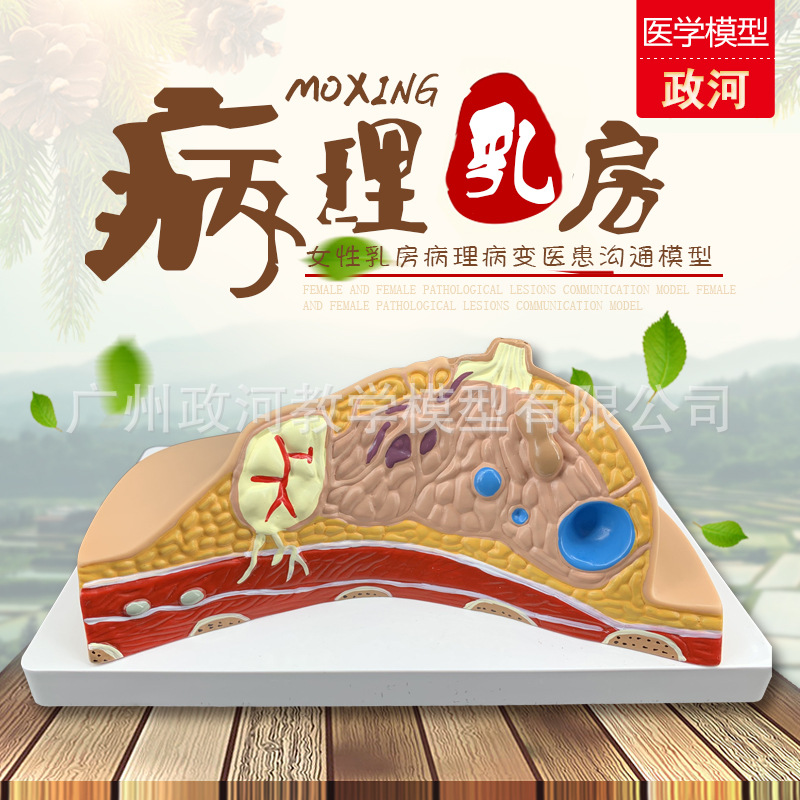 乳房病变模型乳房解剖模型 哺乳培训教具