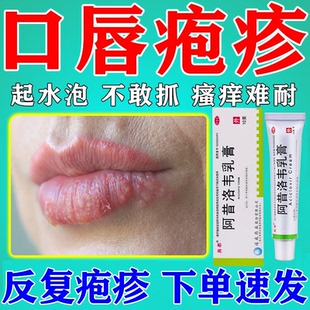 口唇嘴角疱疹起泡烂嘴角起水泡嘴巴脓疮上火单纯带状疱疹阿昔洛韦