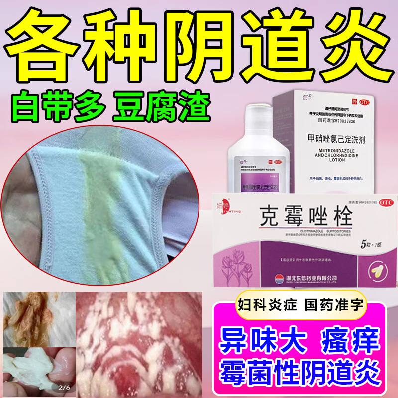 霉菌阴道炎塞专用的药外阴瘙痒白带增多发黄