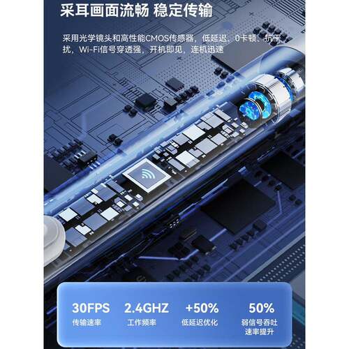 视掏勺儿可童耳掏耳高清光可P5视发挖耳勺专业耳朵采耳工具镊子