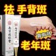 中去老年斑 膏强力去除手部脸部斑专用药膏水正品 黄褐斑