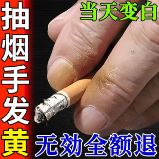 抽烟手指发黄不熏手去除手上烟渍防手熏黑关节黄印烟味神器液