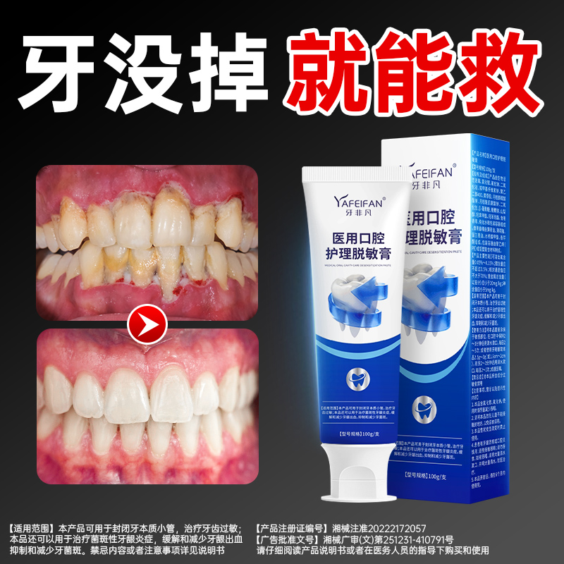 牙非凡医用口腔护理脱敏膏牙周炎牙龈出血专用杀菌消炎抗敏感白