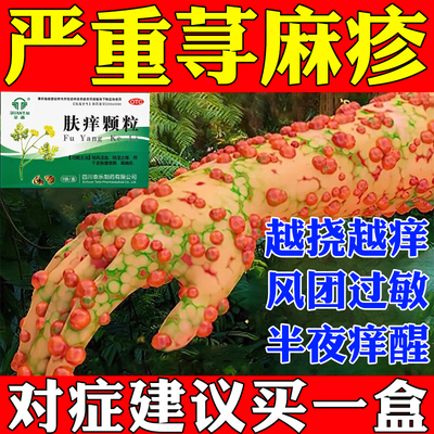 【全泰】肤痒颗粒9g*9袋/盒