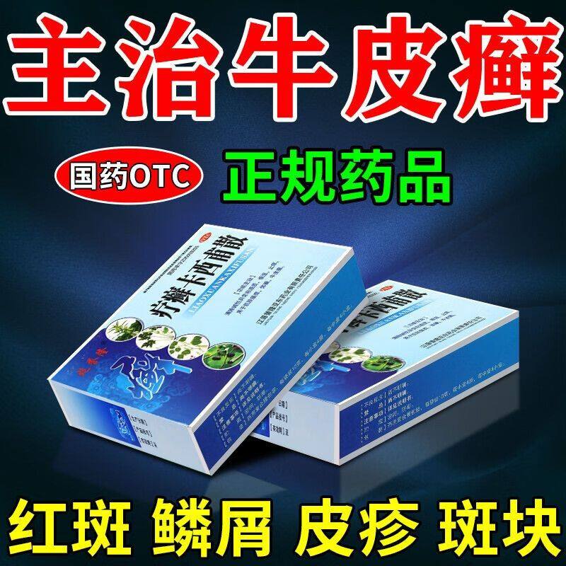治疗牛皮癣的中药皮肤瘙痒止痒治牛皮癣银屑病专用药疗癣卡西甫散