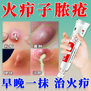 火疖子药膏拔毒拔脓膏脓包硬块疖肿药膏脓肿消炎药红霉素软膏正品