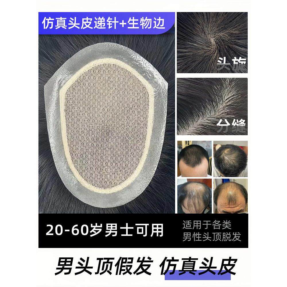 全递针真发男士假发头顶补发片无痕隐形生物头皮帅气高端可粘可卡