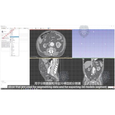 3d slicer医学影像图像分割视频教学教程课程