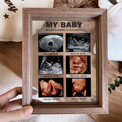 报告单四维照片宝宝B超黑胡桃木相框 孕妇照记录来图定制满月礼物