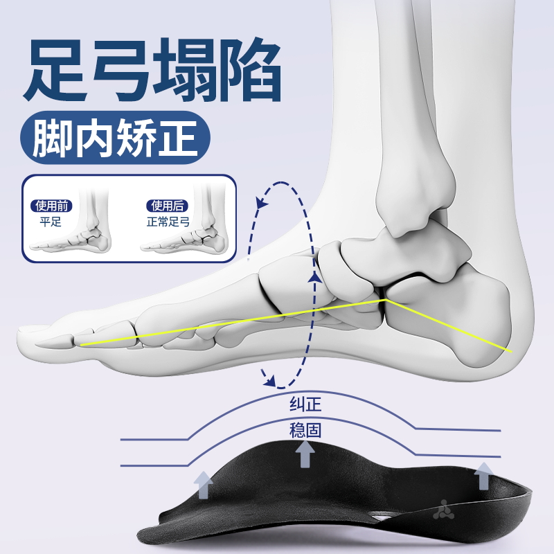 长短腿足弓矫正鞋垫改善腿型塌陷