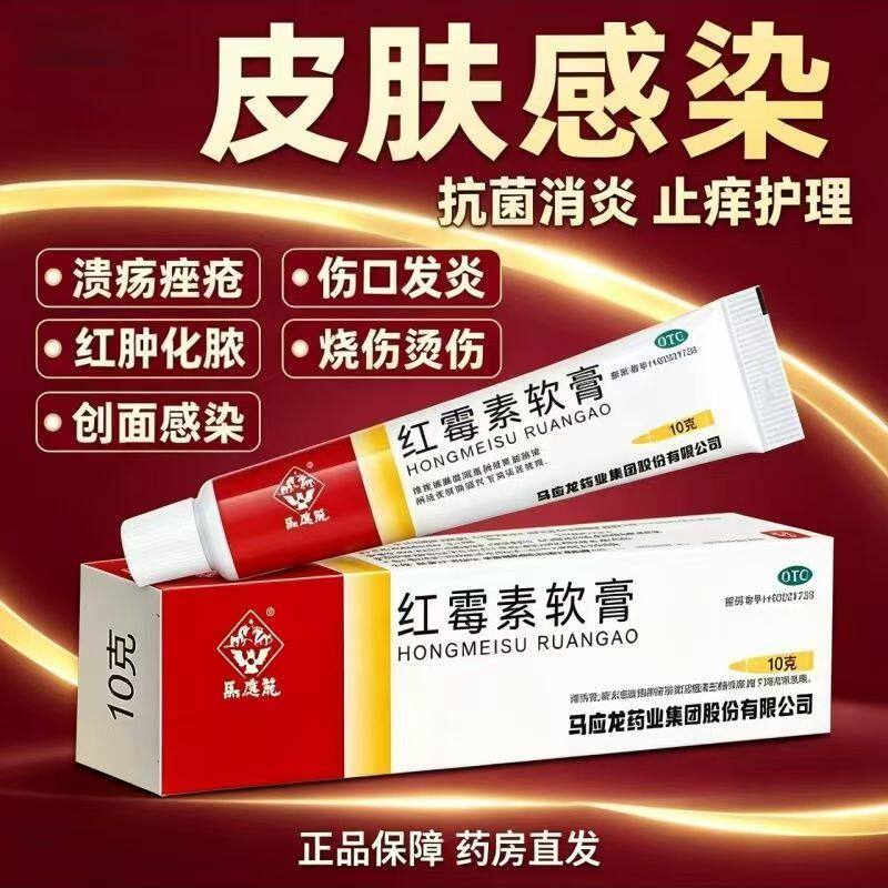 溃疡面感染脓包 化脓性皮肤病寻常痤疮 消炎马应龙红霉素软膏10g