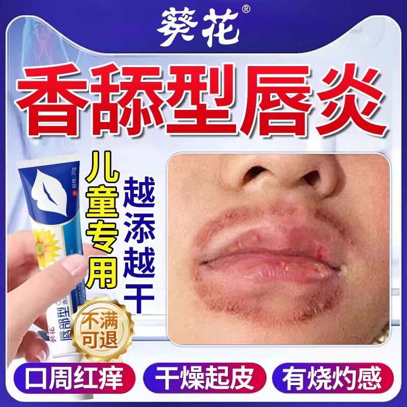 舌舔唇炎专用润唇膏儿童嘴唇防干裂脱皮医用型治剥脱性口角炎