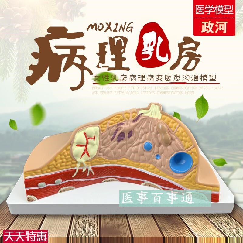 义乳病变模型女性月嫂培训病理模型催乳P师护理模型培训模具