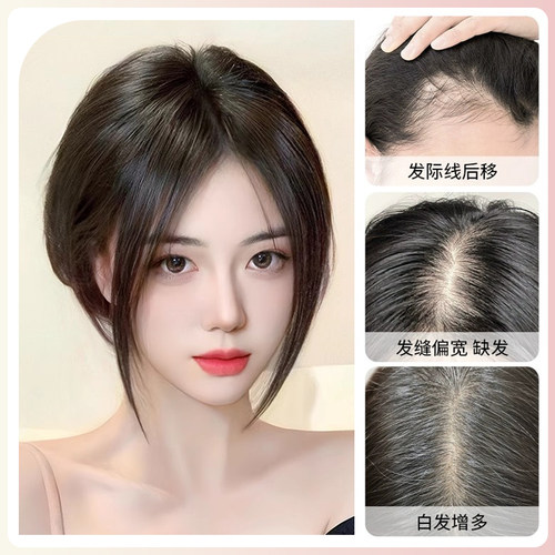 高颅顶假发片女头顶增发量遮白发蓬松全真人发中分八字浏海补发片
