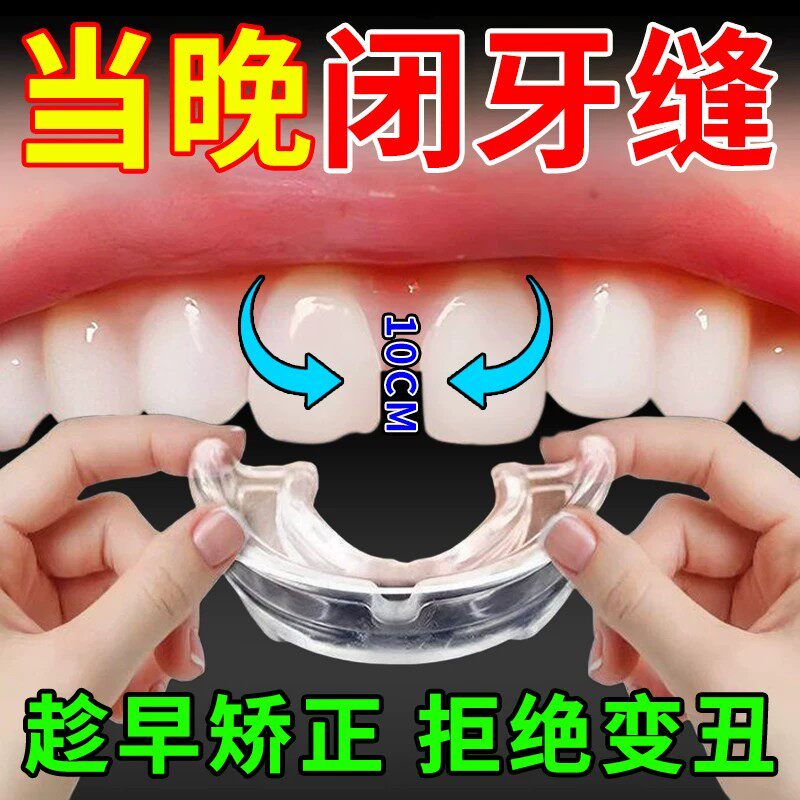 门牙牙缝大矫正器牙缝宽大修复神器成人儿童嘴凸龅牙隐形正畸牙套