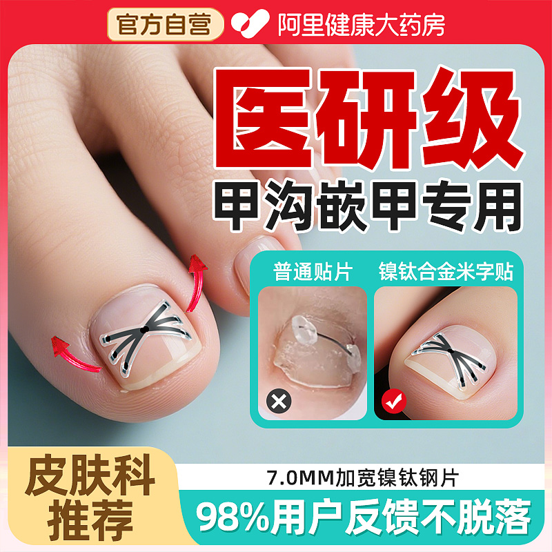 【20000+甲沟炎患者实测】米字形