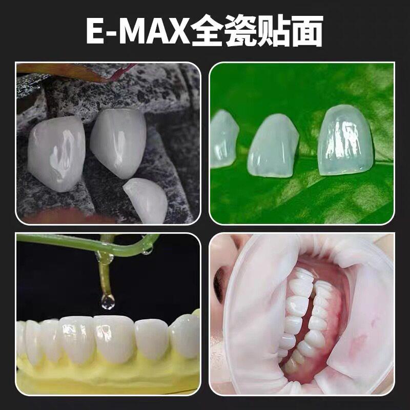 美牙全瓷贴面教学全瓷贴面VITA琥珀瓷义获嘉蓝瓷陶瓷贴片工厂直营