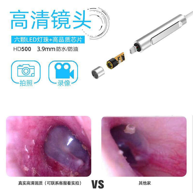 高清耳鼻口内窥镜鼻内耳镜内镜耳朵家用可视鼻腔高清窥视镜镜检鼻