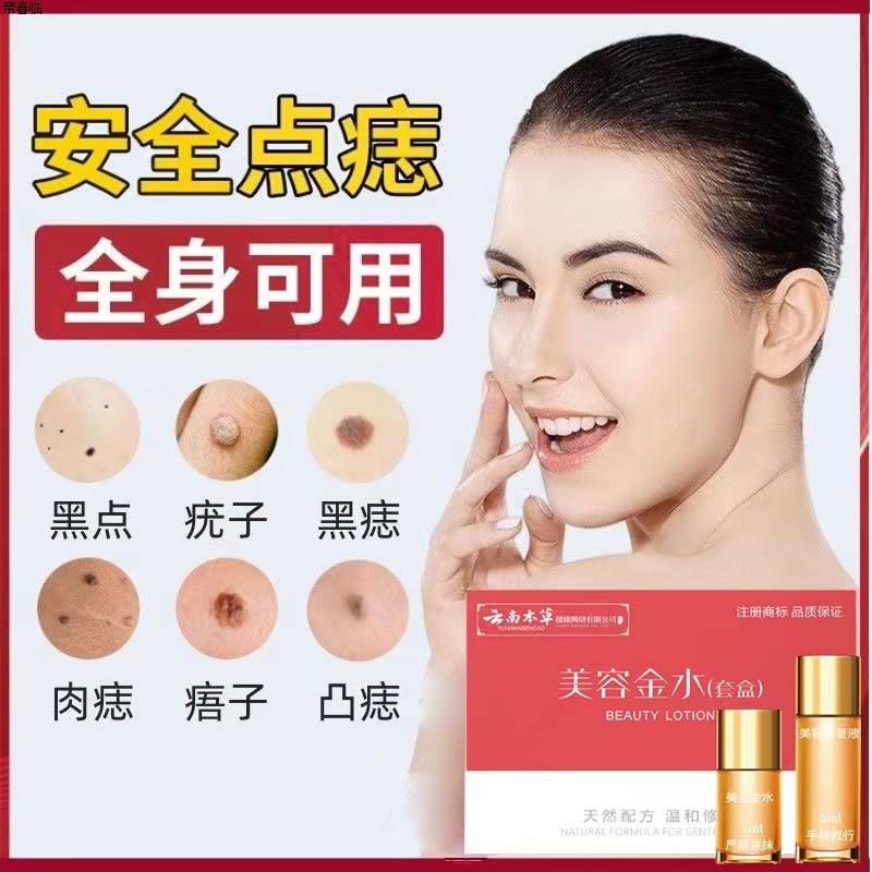 云南本草美容金水点痣液祛痣膏去痣点斑无痕正品院药水脸部修复液