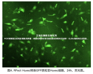 BIOG RFect Huvec质粒DNA转染试剂套装,专用内皮细胞质粒DNA转染