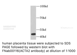 FineTest 内参抗体  未标记一抗，ACTA2抗体，适用ELISA, IHC, WB