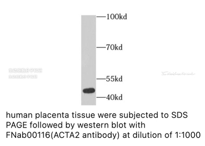 FineTest 内参抗体  未标记一抗，ACTA2抗体，适用ELISA, IHC, WB