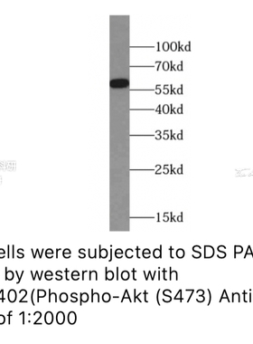 一抗FineTest磷酸化抗体 磷酸-Akt(Ser473)抗体 适用ELISA,IHC,WB