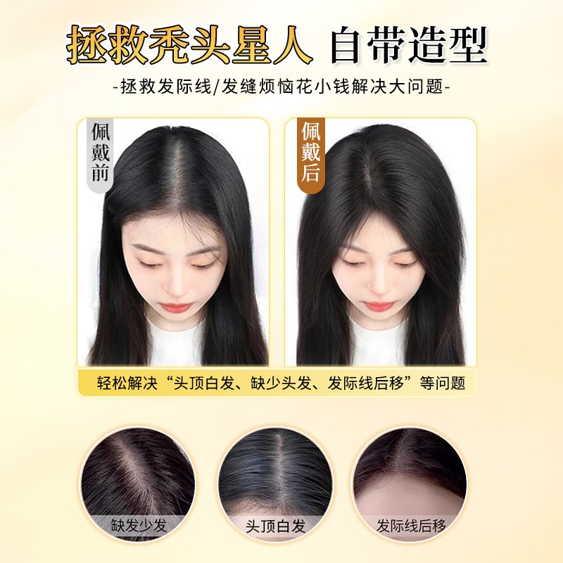 【薄暮-隐形贴】假发女片头顶前额无边真发无痕补发高颅顶刘海片