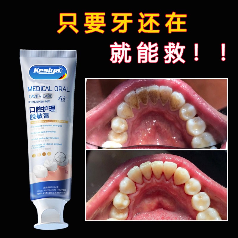 牙膏界的佼佼者德国牙膏牙黄牙黑敏感大牌护理牙膏